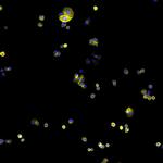 Human IgG (H+L) Cross-Adsorbed Secondary Antibody in Immunocytochemistry (ICC/IF)