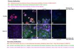 Human IgG (H+L) Cross-Adsorbed Secondary Antibody in Immunocytochemistry (ICC/IF)