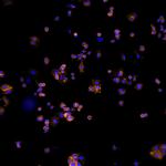 Human IgG (H+L) Cross-Adsorbed Secondary Antibody in Immunocytochemistry (ICC/IF)