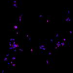 Human IgG (H+L) Cross-Adsorbed Secondary Antibody in Immunocytochemistry (ICC/IF)