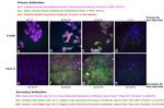 Human IgG (H+L) Cross-Adsorbed Secondary Antibody in Immunocytochemistry (ICC/IF)