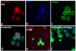 Human IgG (H+L) Cross-Adsorbed Secondary Antibody in Immunocytochemistry (ICC/IF)