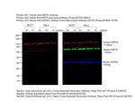 Human IgG (H+L) Cross-Adsorbed Secondary Antibody in Western Blot (WB)