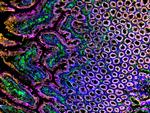 Rabbit IgG (H+L) Cross-Adsorbed Secondary Antibody in Immunocytochemistry (ICC/IF)