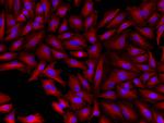 Rabbit IgG (H+L) Cross-Adsorbed Secondary Antibody in Immunocytochemistry (ICC/IF)