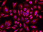 Rabbit IgG (H+L) Cross-Adsorbed Secondary Antibody in Immunocytochemistry (ICC/IF)