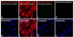 Rabbit IgG (H+L) Cross-Adsorbed Secondary Antibody in Immunocytochemistry (ICC/IF)