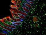 Mouse IgG (H+L) Cross-Adsorbed Secondary Antibody in Immunohistochemistry (Paraffin) (IHC (P))