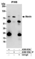 Menin Antibody in Immunoprecipitation (IP)