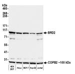 BRD2 Antibody in Western Blot (WB)