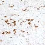 p53 Antibody in Immunohistochemistry (Paraffin) (IHC (P))