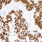 p53 Antibody in Immunohistochemistry (Paraffin) (IHC (P))