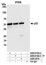 p53 Antibody in Immunoprecipitation (IP)