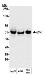 p53 Antibody in Western Blot (WB)