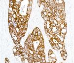 Cytokeratin Antibody in Immunohistochemistry (Paraffin) (IHC (P))