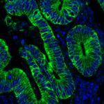 Cytokeratin Antibody in Immunohistochemistry (Paraffin) (IHC (P))