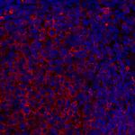 HLA-DR Antibody in Immunohistochemistry (Paraffin) (IHC (P))