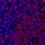 HLA-DR Antibody in Immunohistochemistry (Paraffin) (IHC (P))