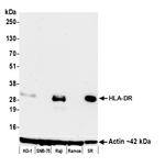 HLA-DR Antibody in Western Blot (WB)