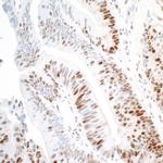 PCNA Antibody in Immunohistochemistry (Paraffin) (IHC (P))