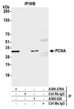 PCNA Antibody in Immunoprecipitation (IP)