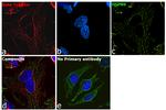 Mouse IgG Secondary Antibody in Immunocytochemistry (ICC/IF)