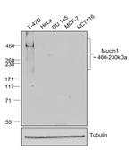 Human IgG (Kappa light chain) Secondary Antibody in Western Blot (WB)