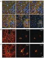 Synapsin 1 Antibody in Immunocytochemistry (ICC/IF)