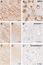 Synapsin 1 Antibody in Immunohistochemistry (IHC)