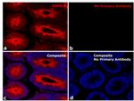 Human IgG (H+L) Secondary Antibody in Immunohistochemistry (Paraffin) (IHC (P))