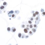 HIF1-alpha Antibody in Immunocytochemistry (ICC/IF)