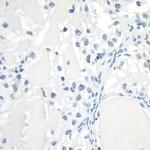 HIF1-alpha Antibody in Immunohistochemistry (Paraffin) (IHC (P))