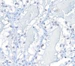 HIF2-alpha Antibody in Immunohistochemistry (Paraffin) (IHC (P))