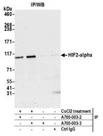 HIF2-alpha Antibody in Immunoprecipitation (IP)