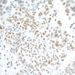 CDK7 Antibody in Immunohistochemistry (Paraffin) (IHC (P))