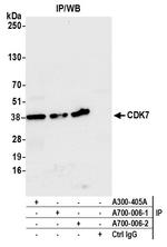 CDK7 Antibody in Immunoprecipitation (IP)