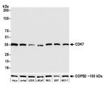 CDK7 Antibody in Western Blot (WB)