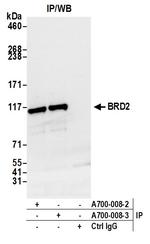 BRD2 Antibody in Immunoprecipitation (IP)