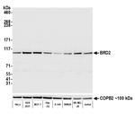 BRD2 Antibody in Western Blot (WB)