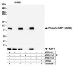 Phospho-KAP-1 (Ser824) Antibody in Immunoprecipitation (IP)