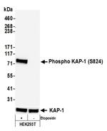 Phospho-KAP-1 (Ser824) Antibody in Western Blot (WB)