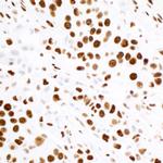 KAP-1 Antibody in Immunohistochemistry (Paraffin) (IHC (P))