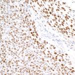 KAP-1 Antibody in Immunohistochemistry (Paraffin) (IHC (P))