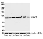 KAP-1 Antibody in Western Blot (WB)