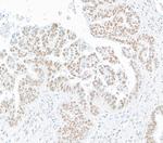 SMC1 Antibody in Immunohistochemistry (Paraffin) (IHC (P))