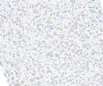 SMC1 Antibody in Immunohistochemistry (Paraffin) (IHC (P))