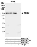 SMC1 Antibody in Immunoprecipitation (IP)