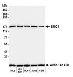 SMC1 Antibody in Western Blot (WB)