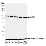 SMC1 Antibody in Western Blot (WB)