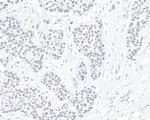 PBRM1 Antibody in Immunohistochemistry (Paraffin) (IHC (P))